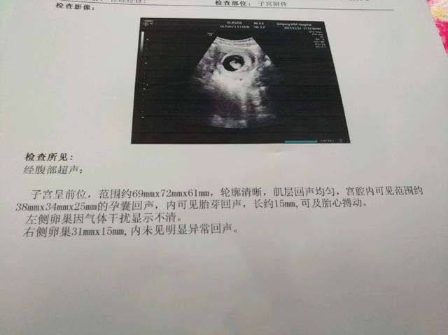 孕8周+3天,B超胎心胎芽都正常_明天开始上班