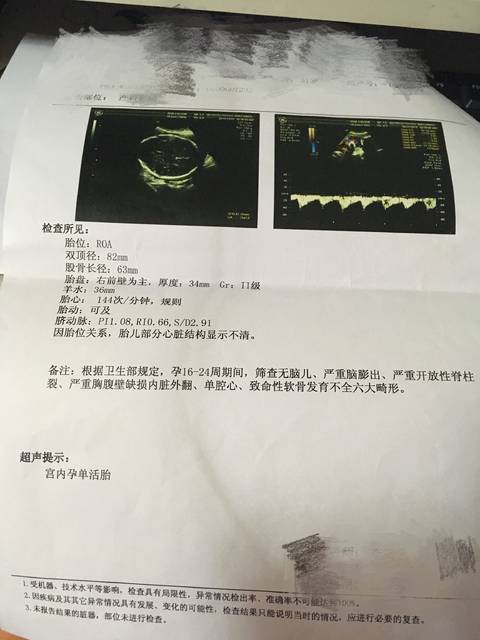 孕34周。宝宝偏小。_孕34周+,去产检,体重宫高