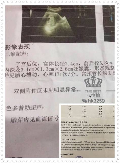 大宝闺女儿,二胎查了儿子_怀孕7周多了,孕早期