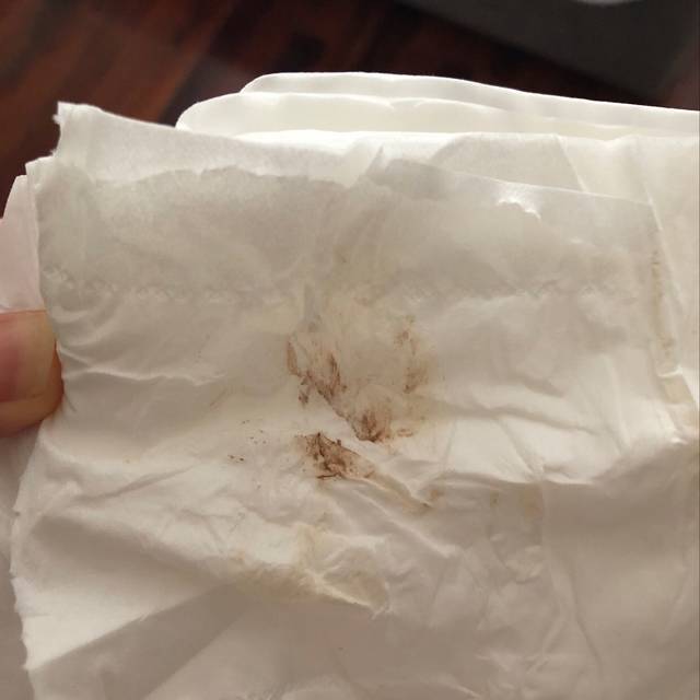 这是不是咖啡色分泌物?需要去医院吗?_昨天晚