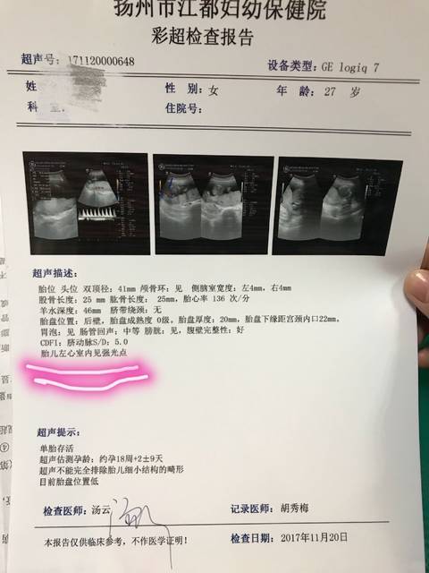 唐氏筛查B超显示胎儿左心室内见强光点_孕17
