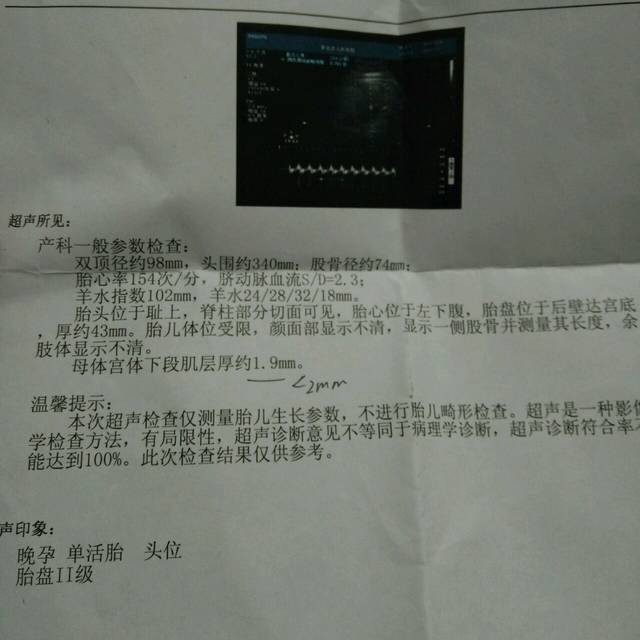 36周的b超数据你们看胎儿偏大吗?