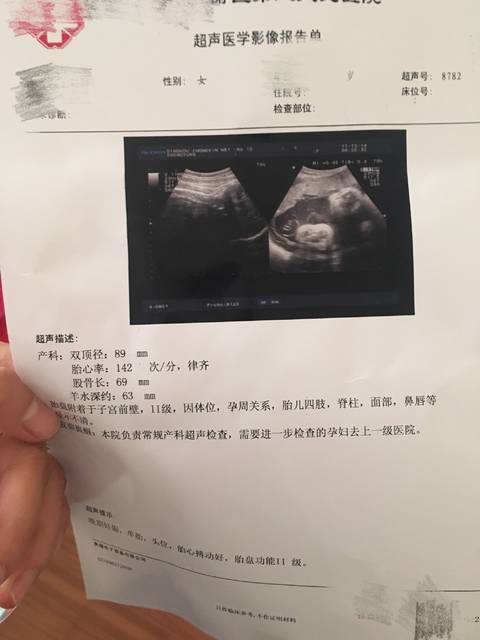 预产期12月23.今天检查的B超单双顶径89,头是
