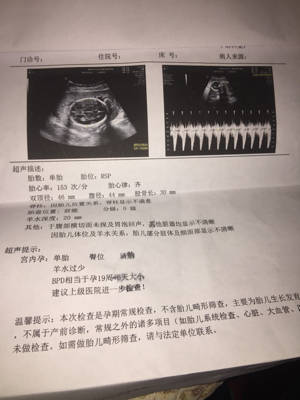 21周做B超胎儿是趴着的看不到脸部,心脏,脊椎