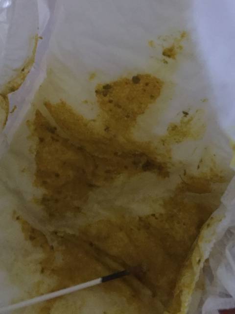 34天宝宝大便有绿色颗粒