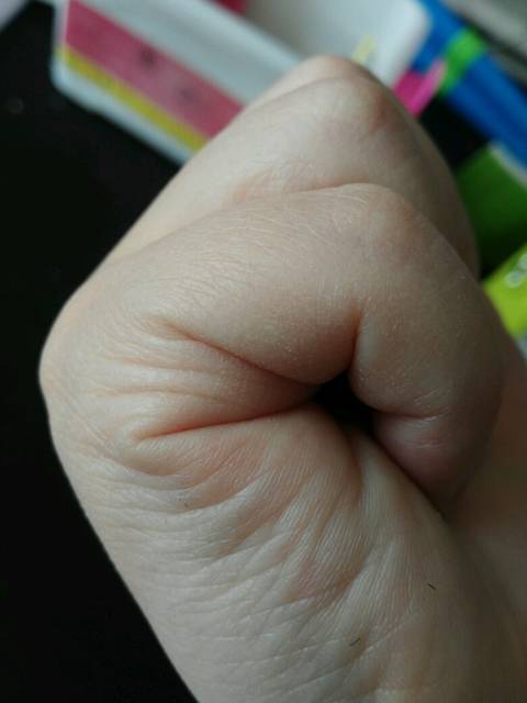 子女线