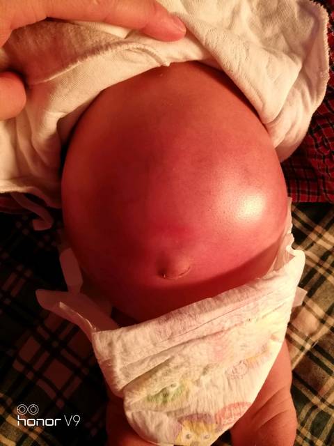 宝宝肚子鼓鼓的,发亮,还老使劲