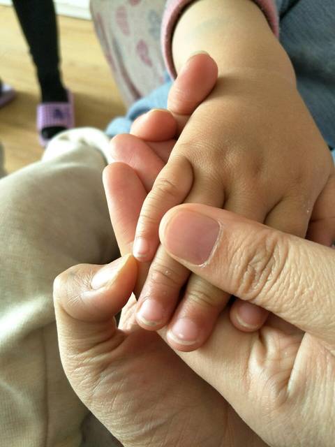 宝宝一岁七个月指甲上有白点,宝妈们有招的请