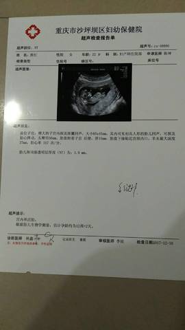 三个月的胎儿。有看懂B超单是男是女的吗?谢