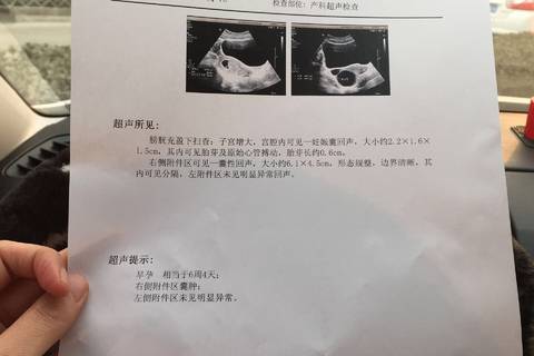 附件囊肿怎么治疗