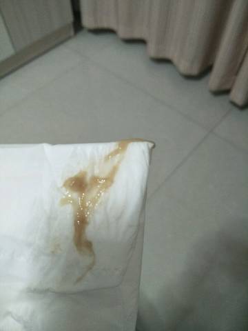 怀孕36周加5,这几天一直分泌褐色鼻涕状分泌物