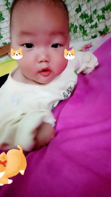 宝宝头发变少了,你们家的宝宝头发多吗?