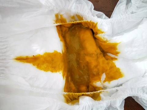 宝宝80天,每天拉一次便便,便便稀,像芝麻酱,持