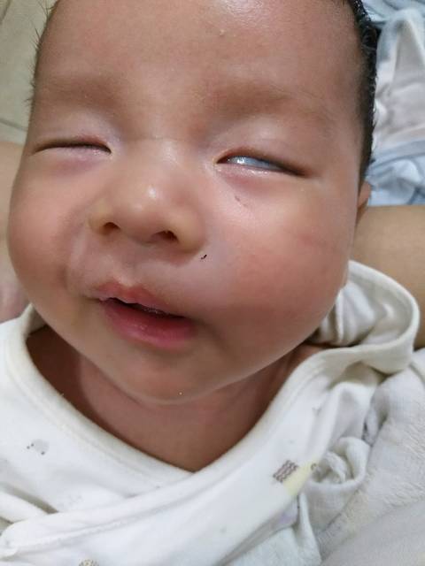 宝宝两个月,躺着玩的时候眼睛往下看,翻白眼