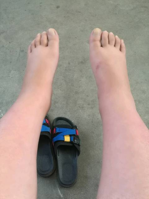 37周没入盆,大家都什么时候测骨盆啊?测的时候