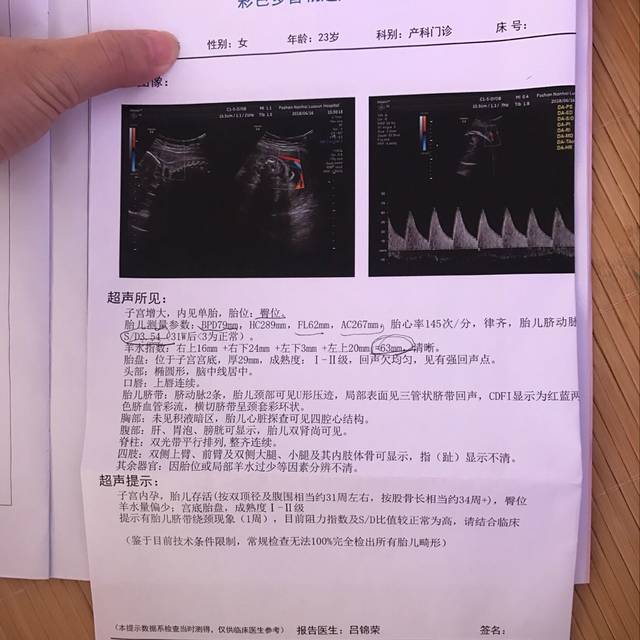 头偏小几周腿就很长!还有羊水偏少那个sd过高