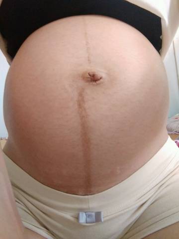 各位宝妈帮我看看二胎怀的是男宝女宝 照片分