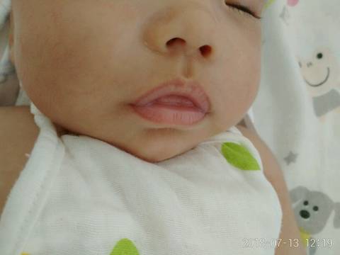 50天婴儿嘴唇边颜色变深。
