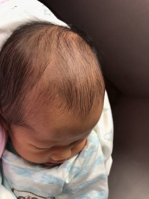 孕期一定要天天吃钙片呦~宝宝刚出生头中间骨