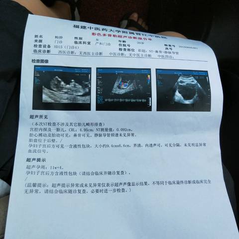 孕11周三天去医院做nt说检查出来子宫后方有液