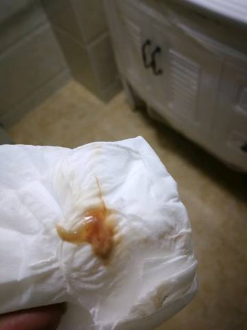 月经过后流咖啡色液体 流的量挺多的 具体连续也不知道 只要一同房就