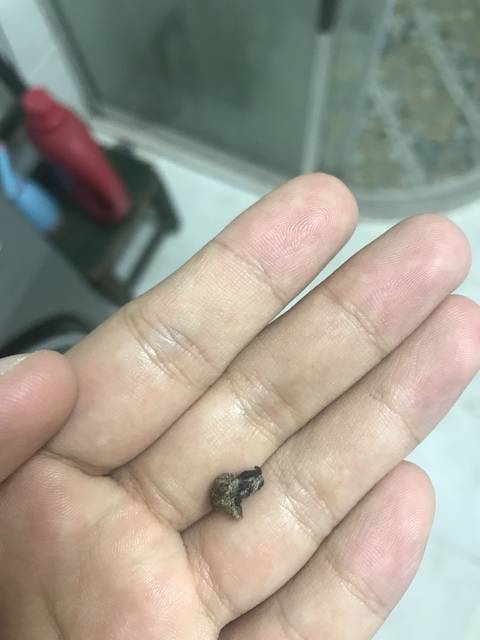 肚脐眼的脏东西自然脱落要紧吗?