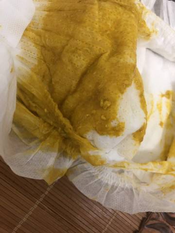 是不是受凉了 .两个月的宝宝,怎么办?有时候还有粒状,纯母乳