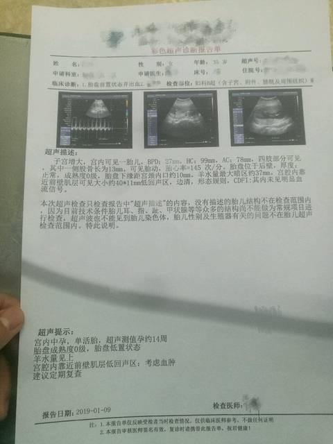 【新手报到】胎盘低置出血9日出院,彩超显示宫