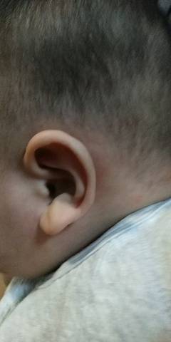 3个月宝宝睡觉睡的耳朵一大一小,生下来