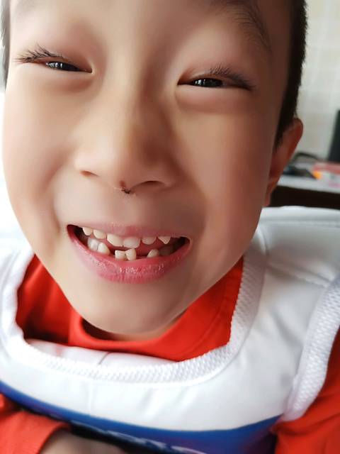 有没有孩子的下牙齿虎牙前面只长两颗牙的?