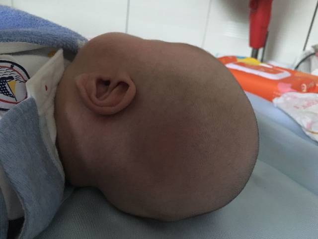 头型侧睡宝宝变长了?怎样v头型齐刘海图片