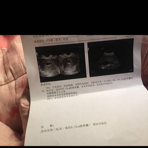 育儿问答 怀孕期 孕40天左右,今天去做b超,医生说胎儿没有长起来,不好