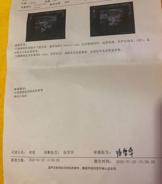 新生儿血肿_宝宝脖子右侧有抹进去硬硬的包块,生出两