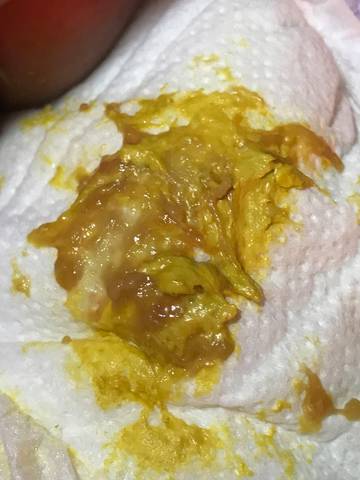 新生儿26天,大便有虫状粘液