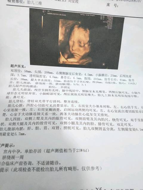 四维彩超顺利通过!