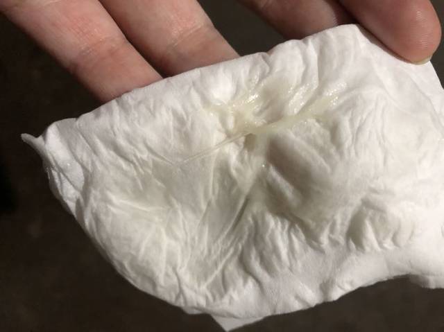 这是宫颈粘液吗?是快生了吗