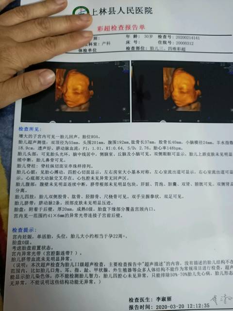 各位宝妈们,今天刚做的四维,谁能告诉是男宝宝还是女
