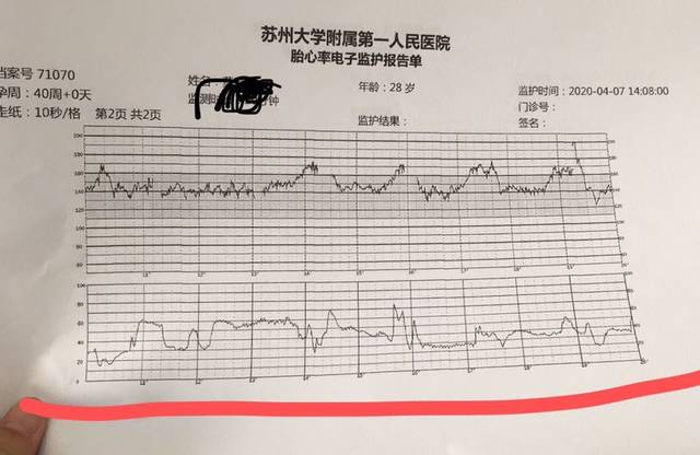 怎样才是要生的宫缩图