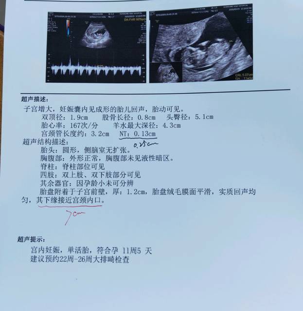 三个月时b超,可以看出什么情况吗_可以看男孩女孩吗