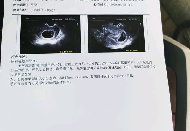 孕7周多彩超报告