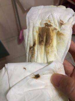 孕晚期出现褐色分泌物是否正常_孕37周白带检查,医生