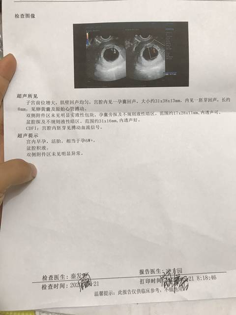 请过来人告诉我好还是不好,医生说有点先兆流产…开