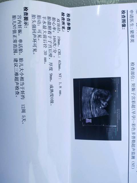 12周 6,今天nt通过_但是彩超为什么只有宝宝上半身,我