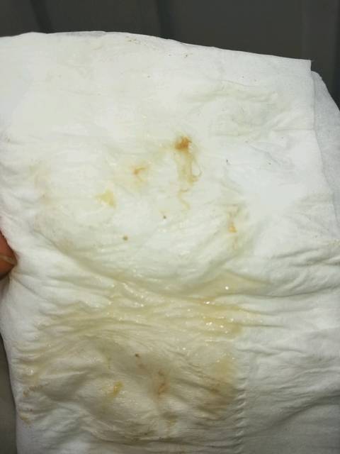 孕8周了还是只有大便时就有浅褐色的分泌物