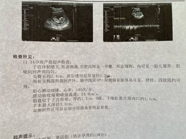 nt看男女～报告单新鲜出炉