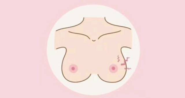 【哺乳期两侧乳房大小不一样怎么办?】