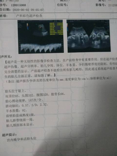 孕34周宝宝头大腿短