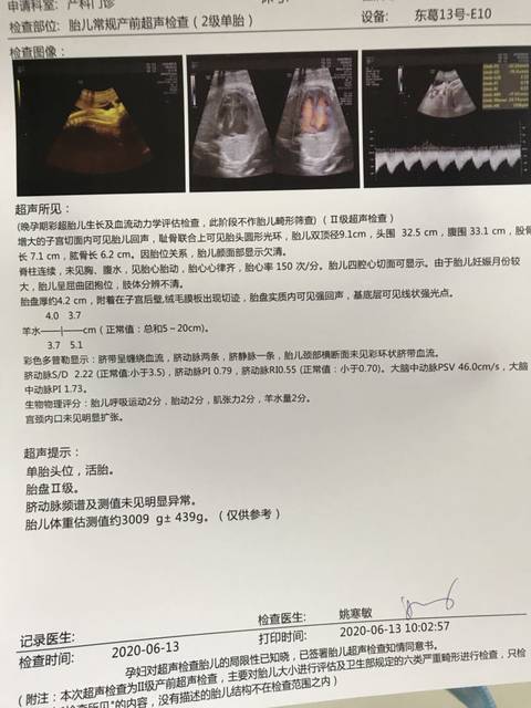 新鲜出炉b超单