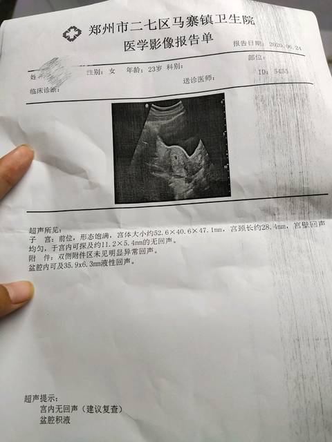 30多天没有胚胎胚芽胎心就被医生下了先兆流产,这正常
