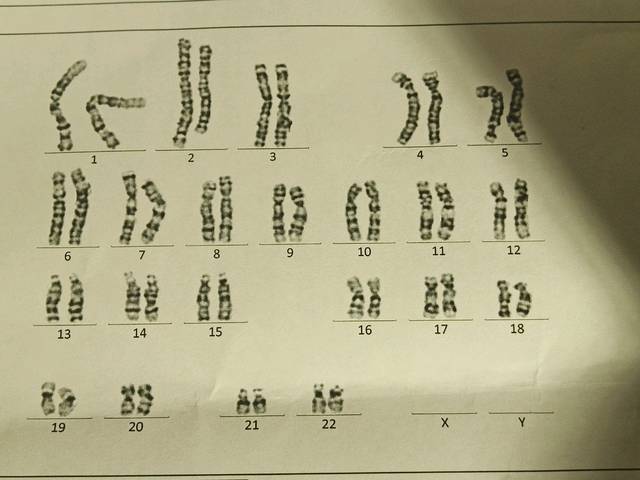 请大家帮我看看是不是男孩_染色体核型分析报告_宝宝树